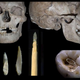 Imagen para el artículo titulado Hallan la 1ª prueba de intervenciones dentales hace 14.000 años
